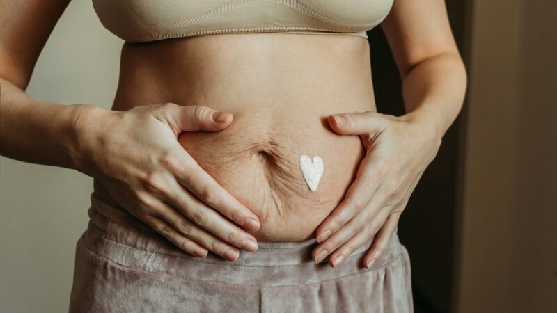 What a Post-Pregnancy Tummy Really Looks Like