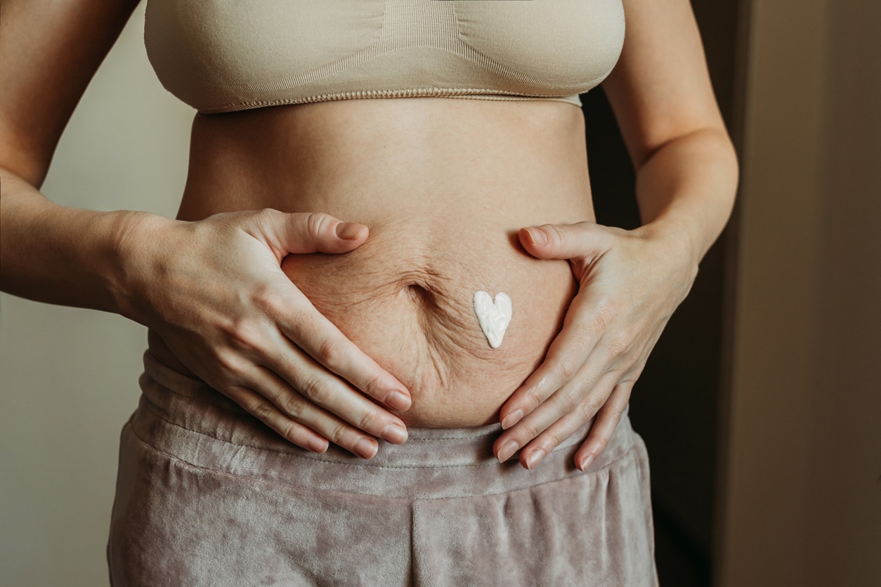 What a Post-Pregnancy Tummy Really Looks Like