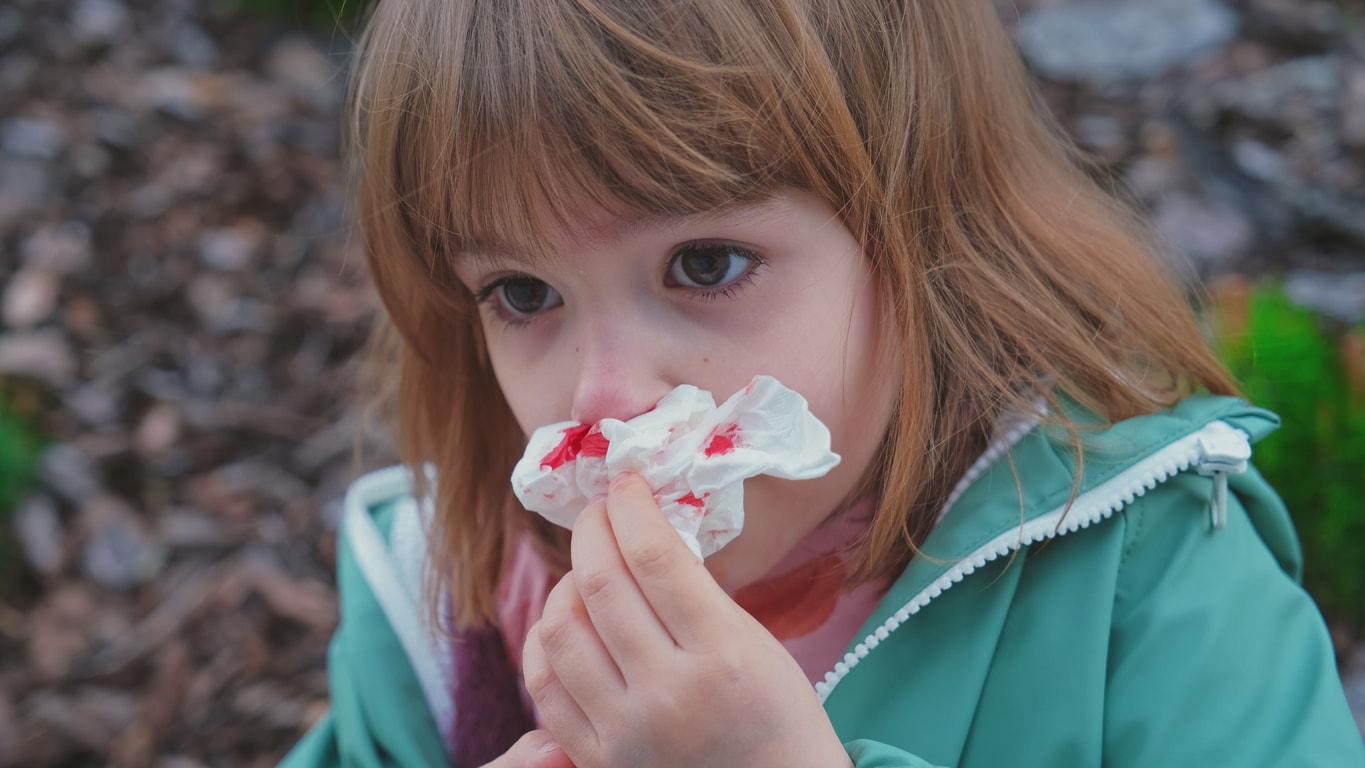 What a Bloody Nose in Kids Means and How To Treat It