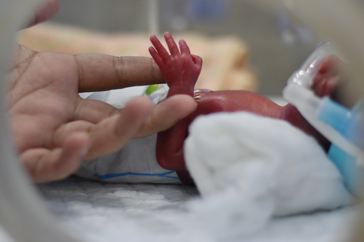 Preemie Developmental Milestones: What To Expect
