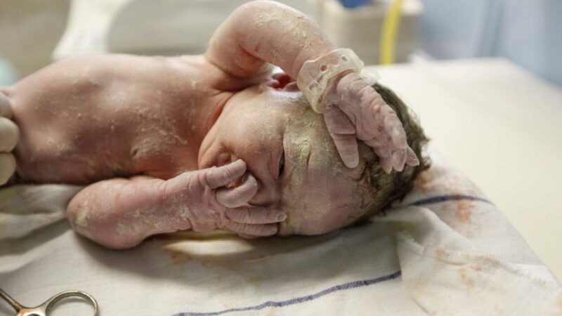What Is Vernix and Why Is It All Over My Newborn?